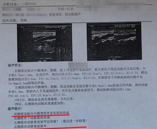 手机前置为什么卡住不能用