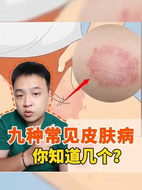 皮肤病