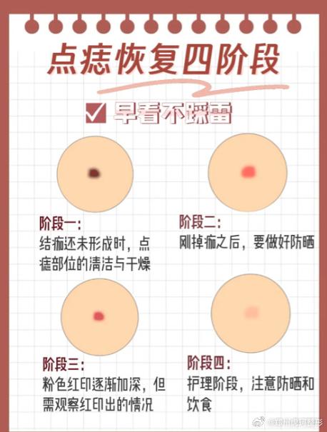 坏点修复软件居然有用