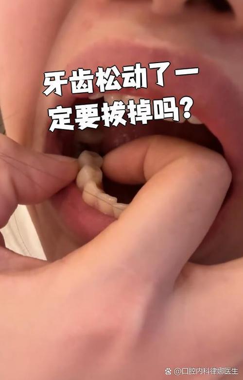 牙齿松动拔掉好吗缩略图