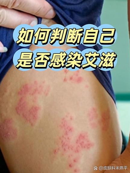 艾滋病毒的发现者