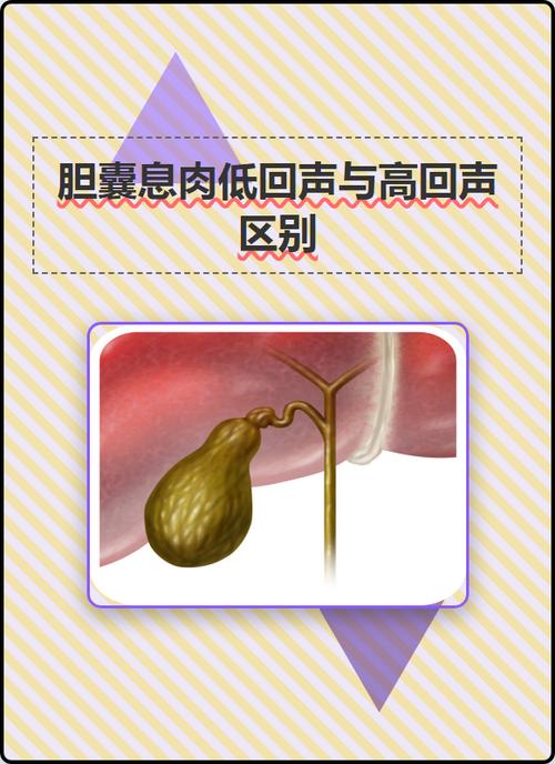 回声和回音的区别
