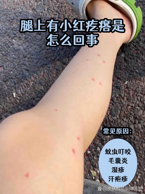 小红书赚钱方式