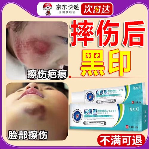 烫伤的红印子用什么药能尽快去掉