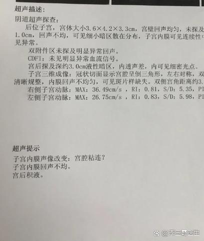 超大附件30天后不可下载
