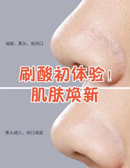 40岁适合bb霜还是cc霜截图