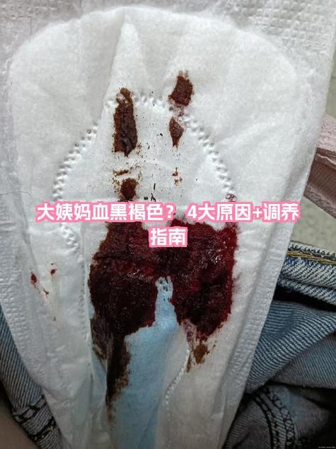 光见褐色血,月经下不来怎么办