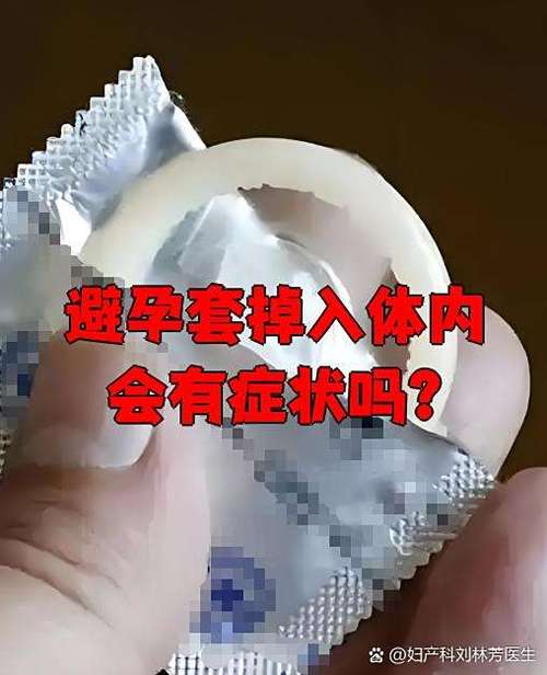 套子掉内了一般几天能发现
