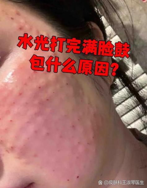 打完脸上出现红色点