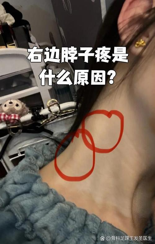右边脖子酸痛什么原因游戏截图
