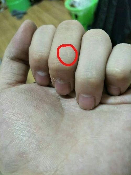狗抓一条白痕没破皮