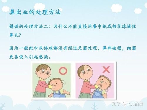 怎么快速止住流鼻血