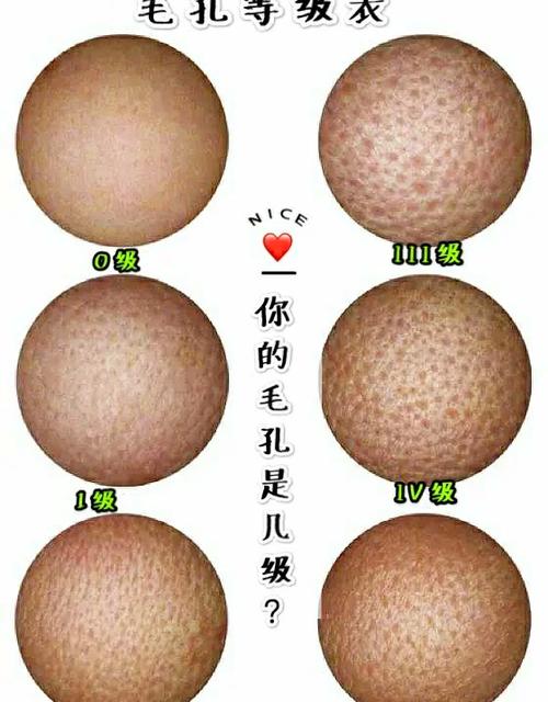 怎么消痘痘图标