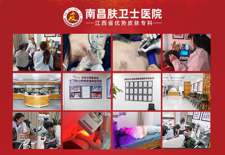 青春痘去哪个医院看好