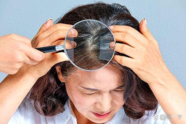 染发不上色的小妙招截图