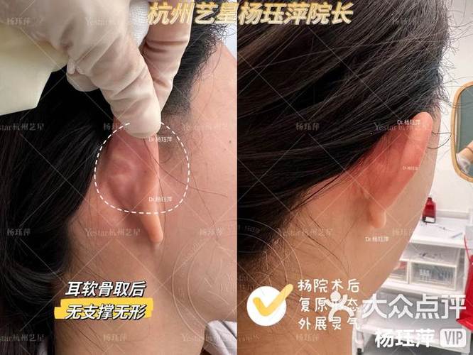 耳机音质突然变差嘈杂
