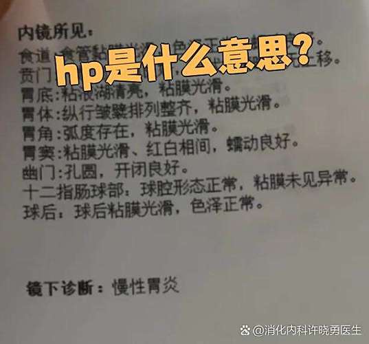 hp啥意思图标