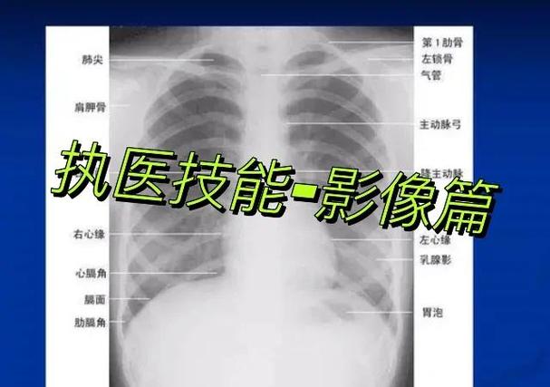 ct反投影法基本过程