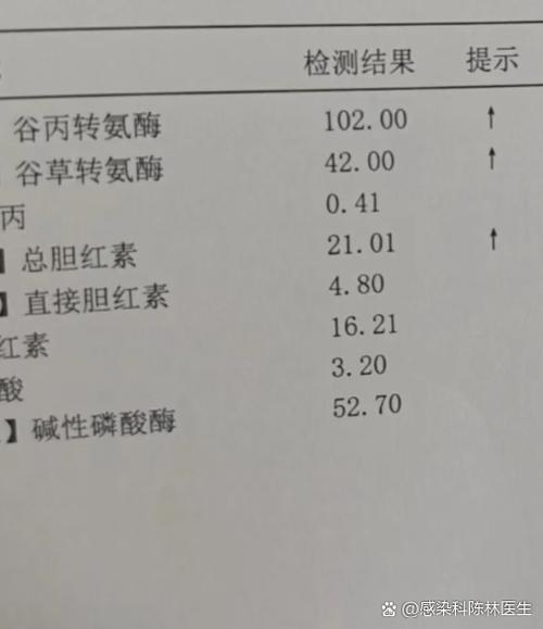 肝功谷丙转氨酶偏高