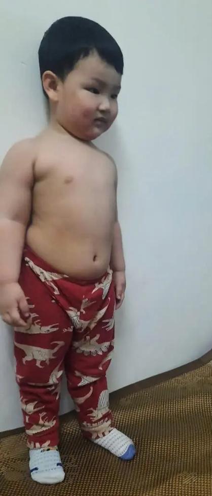 15小孩发育粗大