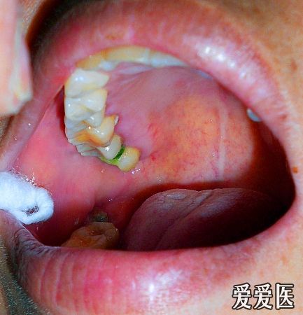 身上红斑块不痛不痒游戏截图
