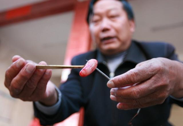 小鸡割下手术视频