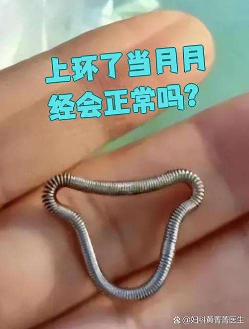 上环什么样的环好
