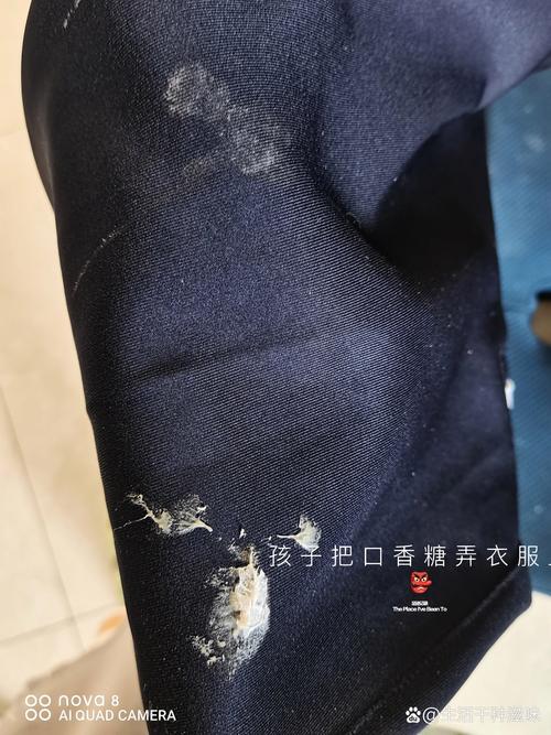 衣服上粘了口香糖的解决方法截图