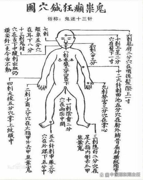 鬼门十三针准确位置