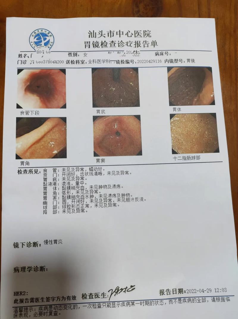 鸡腺肌胃炎用什么药最好