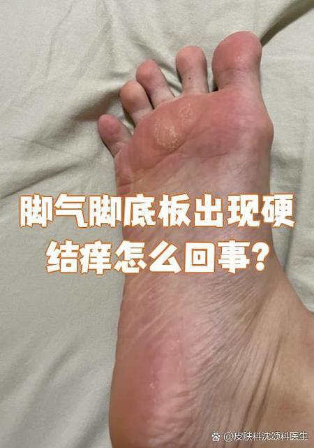 如何挠脚底最痒缩略图