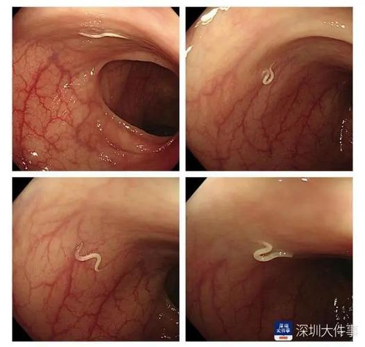 美女肚子里的寄生虫在乱动