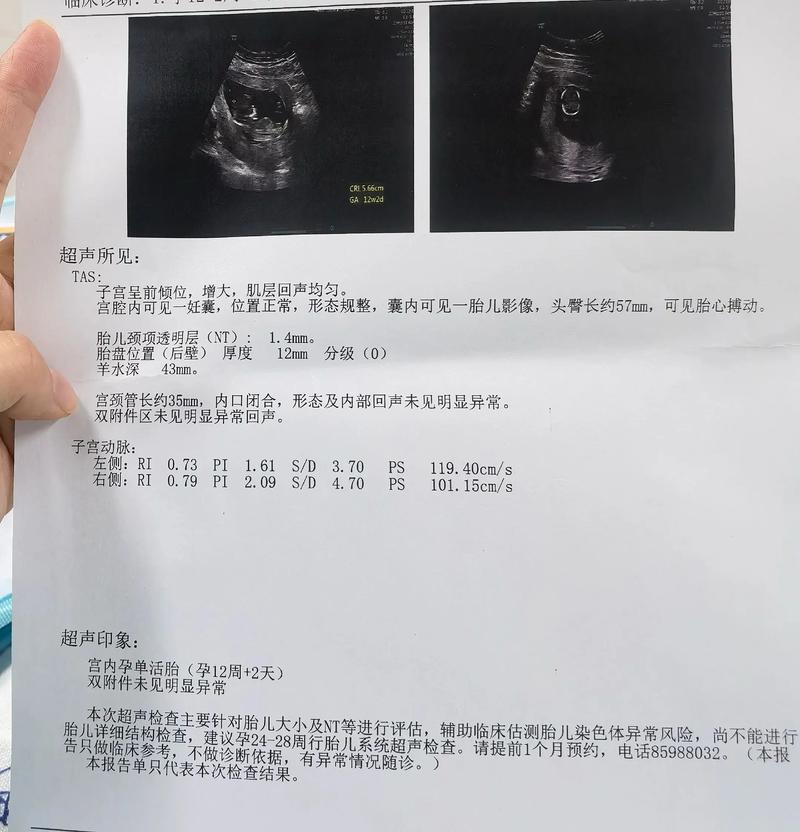 nt值2.7引产了