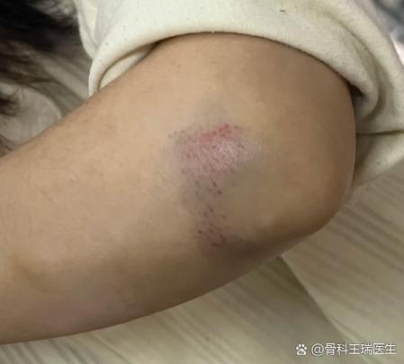手机摔完之后反应迟钝