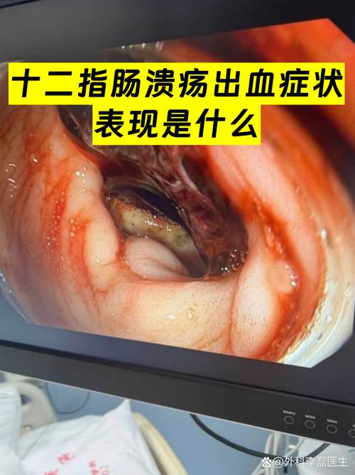 呕血谱是真的吗