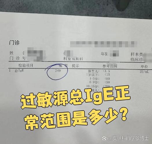 总ige高一定是过敏吗