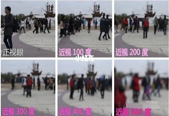散光与近视哪个可怕