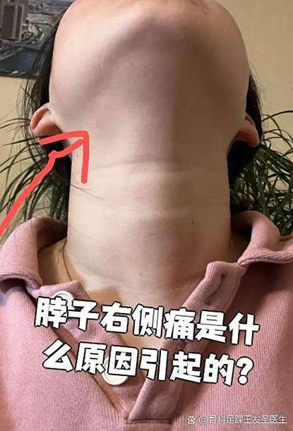 颈项右侧疼痛什么原因