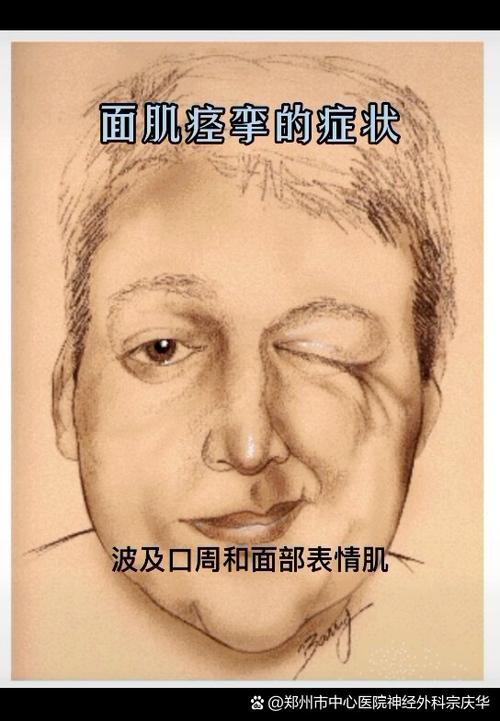 面部一边肌肉跳怎么办