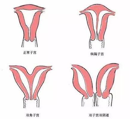 子宫声音婴儿听白噪音缩略图