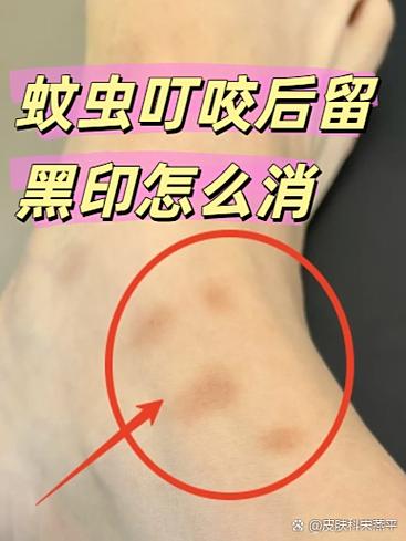 手机屏上有黑印是咋了