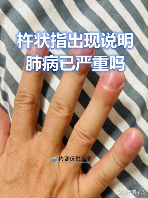 九天是指哪九天截图