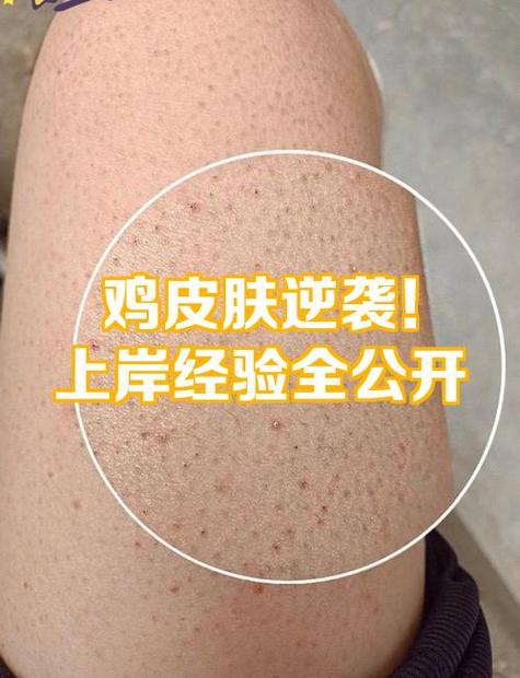 鸡身上有红点是什么原因