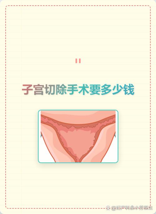 刮宫手术费一般多少钱