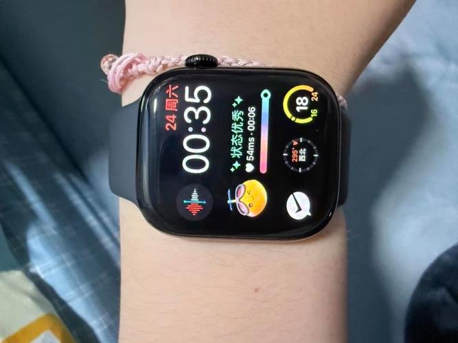 Applewatch
