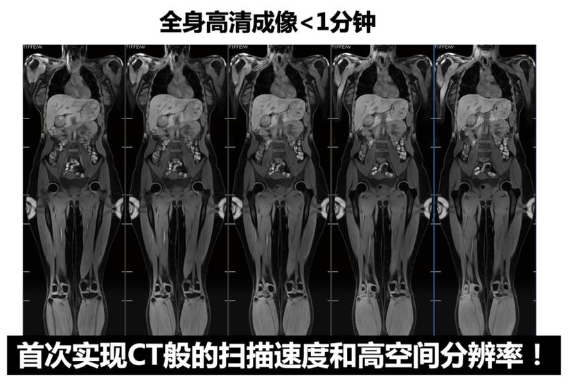 磁共振清晰度级别