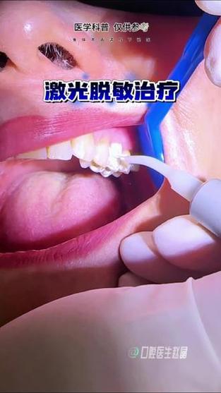 牙齿激光脱敏治疗的原理是什么图标