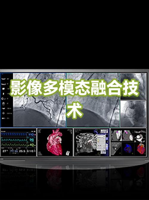 怎样制作多个照片同框