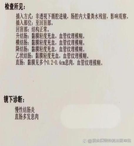大便细小像挤牙膏似的