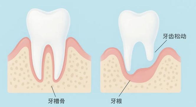 如果预防牙齿松动